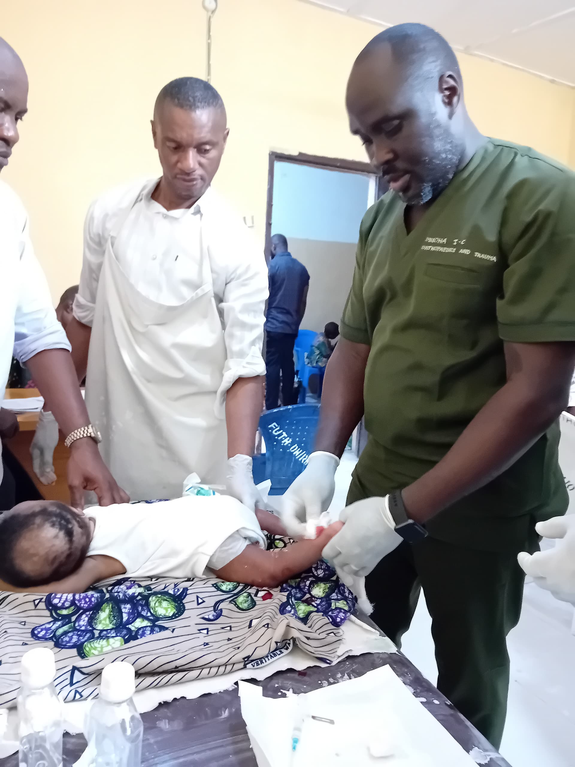 Over 100 Nigerian Children Begin Clubfoot Treatment as TSCF Reports Strong Progress Amid Rising Costs